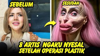 GAGAL CANTIK 8 artis ini mengaku menyesal setelah Lakukan operasi plastik [upl. by Karilynn229]