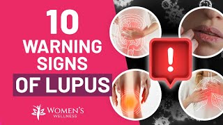 10 Vital Warning Signs of Lupus [upl. by Orual]