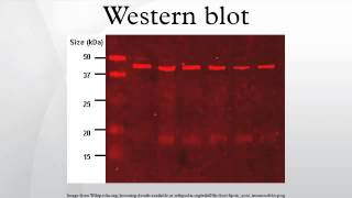 Western blot [upl. by Sukramed]