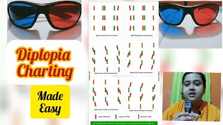 Diplopia Charting [upl. by Strauss834]