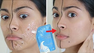 I tested VIRAL SALICYLIC ICE MASK amp THIS HAPPENED  Does the ice mask work instantly 😳 [upl. by Peterec]