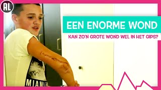 WAT ALS JE HELE ARM EEN WOND IS  TOPDOKS SEH [upl. by Gratia]