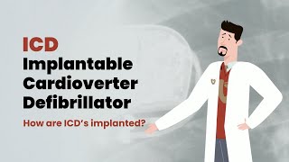 How Does an ICD Work Your Heart Rhythm Safety Net Explained [upl. by Eade89]