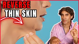 INEXPENSIVELY REVERSE SKIN THINNING AT HOME [upl. by Ecinerev459]