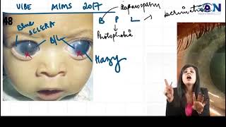 One shot ophthalmology for neet pg  inicetbuphthalmos [upl. by Risteau]