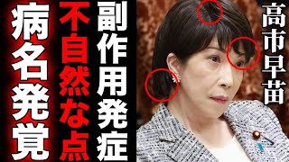 難病発覚！応援依頼が殺到する高市早苗が抱えるもの…「薬の副作用で毛がほとんど…」急激に身体に起きた目に見えてわかる姿に言葉を失う…実子が出来ない理由に驚きを隠せない… [upl. by Yenrab]