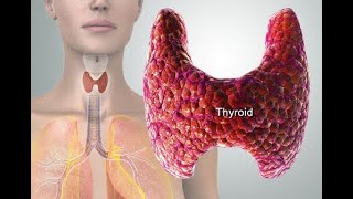 AmiodaroneInduced Thyroid Dysfunction AIT [upl. by Goober]