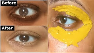 Turmeric Eye mask to Remove DARK CIRCLES Under Eye wrinkles amp under eye bags [upl. by Genovera875]