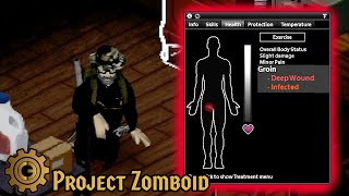 Jim Needs Help Part 2  Project Zomboid CDDA Challenge [upl. by Eitac]