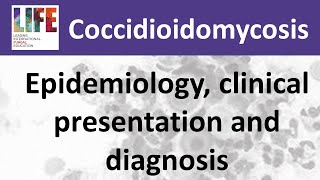 Coccidioidomycosis – epidemiology clinical presentation and diagnosis [upl. by Godber]