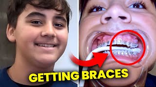 Patient getting BRACES on…full process  McKinney Orthodontist [upl. by Kolk]