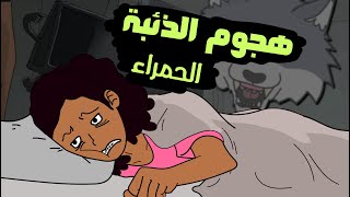 مرض العصر متأخر التشخيص الذئبة الحمراء  lupus [upl. by Nnaycart156]