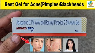 Minoz BPO Gel Use in Hindi  Minoz BPO Gel Benefits Side effects  Acne  Blackheads  SK Medicine [upl. by Sevart]