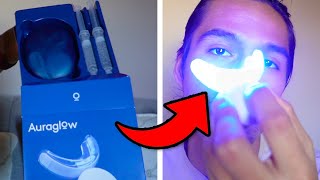 What To Expect With The Auraglow Teeth Whitening Kit [upl. by Sivraj129]