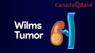 Wilms Tumor [upl. by Genet331]