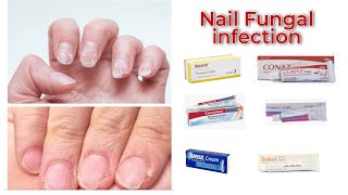 Nail Fungal infection treatment in Urdu handi  ketocinazole cream Tarbinafen cream Fungal cream [upl. by Auoh773]