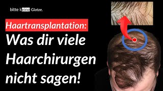 Empfängerbereich Haartransplantation Basic Wissen [upl. by Dalila]