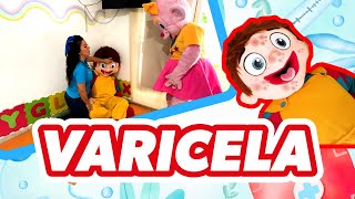 VARICELA  VÍDEOS PARA NIÑOS [upl. by Yort795]