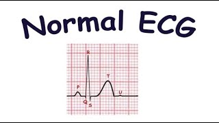 Normal ECG Kya hai  ECG ki Pehchan [upl. by Esaj684]