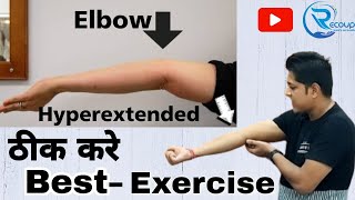 hyperextended elbow treatmentkohni ka tirchapan kaise thik kareelbow deformity elbows elbowpain [upl. by Bev]