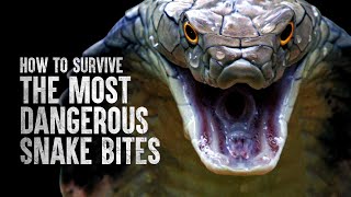 How to Survive the Most Dangerous Snake Bites [upl. by Harle]