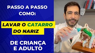 Como lavar o catarro do nariz com soro fisiológico e desentupir o nariz de criança e adulto [upl. by Harbour]