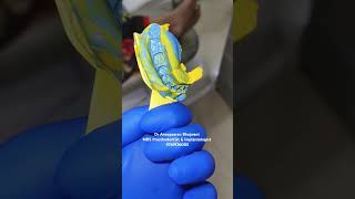 Tripletraytechnique prosthodontics impressionsrubberbase dentist dentalclinic prosthodontist [upl. by Ilyah]