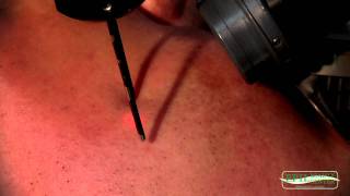 LASER DEPILAZIONE VISO Epilbeauty Tel 0541787808 [upl. by Malamut]