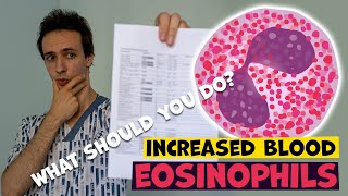 High blood EOSINOPHILS causes and what to you do [upl. by Manon]