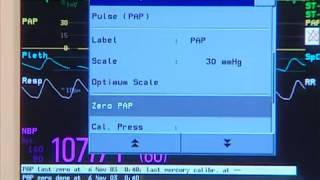 Invasive Pressure Setting up [upl. by Henarat]