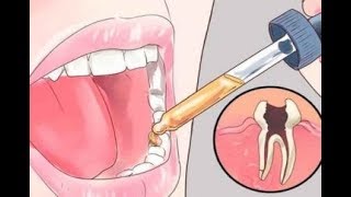 12 All Natural Toothache Remedies Your Dentist Doesn’t Want You to Know About [upl. by Anthiathia]