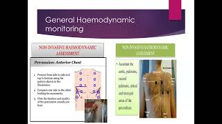 Haemodynamic monitoring Invasive Blood Pressure Measurement [upl. by Latsyrhc650]