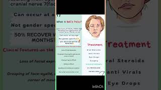 Bells Palsy Facial Paralysis shortvideoshortfeed [upl. by Othella]