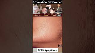 PCOS Symptoms  PCOS ki Alamaat [upl. by Hairej]