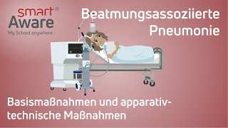 Beatmungsassoziierte Pneumonie Basismaßnahmen amp apparativtechnische Maßnahmen  Fortbildung Pflege [upl. by Ecirtnahs]