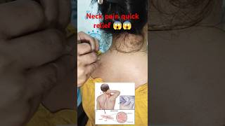 Neck pain quick relief shorts neckpain dryneedling youtubeshorts shortvideo [upl. by Nimesay768]