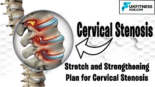 Complete Cervical Stenosis Exercises and Stretch Plan For Pain Management and Postural Correction [upl. by Halimeda604]