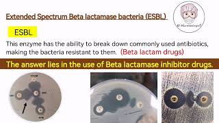 ESBL bacteria Extended Spectrum Betalactamase Bacteria  Antibiotic Resistance English [upl. by Nivk]