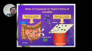 Opportunistic Mycoses I  Candidiasis [upl. by Aslam]