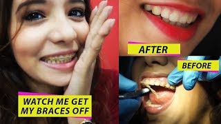 WATCH ME GET MY BRACES OFF amp THE DRASTIC CHANGE IN MY TEETH [upl. by Menides173]