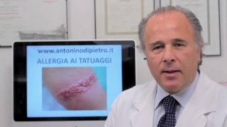 Prof Antonino Di Pietro  Allergia da tatuaggi [upl. by Waneta]