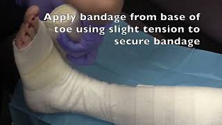 Application of surepress long stretch compression bandage [upl. by Ehttam]