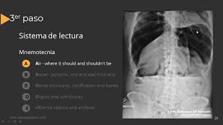 Radiografía de Abdomen Paso a Paso [upl. by Botzow]