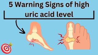 5 Warning signs of high uric acid levels [upl. by Eecyaj]