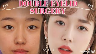 Plastic Surgery Korea Experience  Double Eyelid Surgery amp V Line Surgery in Korea Part 2 [upl. by Aguie]