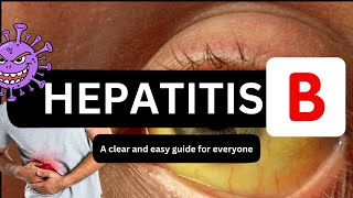 Hepatitis B  Hepatitis B Symptoms  Hepatitis B Tests  Hepatitis B By Dr Shams [upl. by Tnomal]