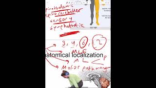 Anatomical localization of neurological lesions  Part 4 [upl. by Relyhcs725]