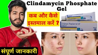 Clindamycin Gel Uses and Side Effects  Clindamycin Gel Review Clindac A Gel [upl. by Ailadgim]