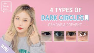 How to Remove Dark Circles Under Eyes In The Most Effective Way  Teen Beauty Bible [upl. by Donaldson623]