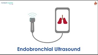 Exploring Endobronchial Ultrasound for Lung Diagnosis l Manipal Hospitals Bengaluru [upl. by Eimmij]